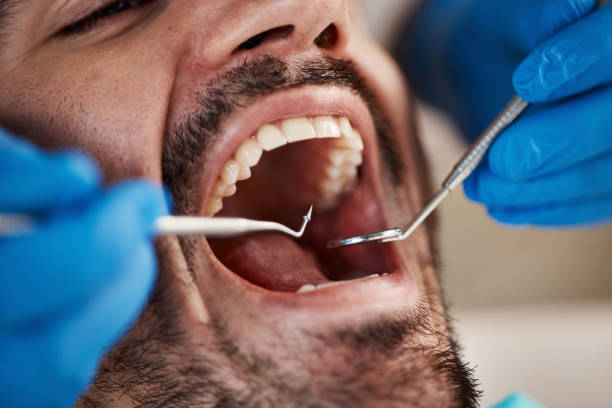 Best Urgent Care for Lost Fillings or Crowns in Mount Penn, PA